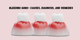 Bleeding Gums- Causes, Diagnosis, and Remedies