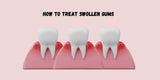 How to Treat Swollen Gums