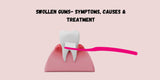 Swollen Gums- Symptoms, Causes & Treatment