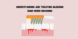 Understanding and Treating Bleeding Gums When Brushing
