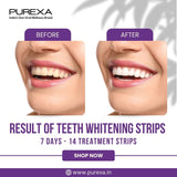 Teeth Whitening Strips